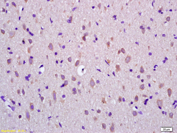 Apolipoprotein D Rabbit Polyclonal Antibody