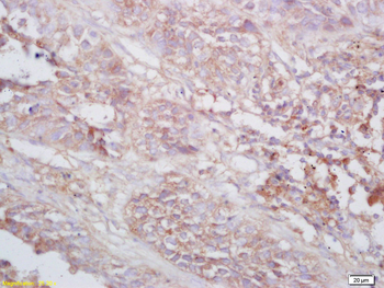 TNMD Rabbit Polyclonal Antibody
