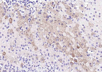 FTO Rabbit Polyclonal Antibody