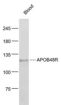 APOB48R Rabbit Polyclonal Antibody
