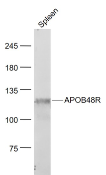 APOB48R Rabbit Polyclonal Antibody
