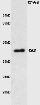 PTGER1 Rabbit Polyclonal Antibody