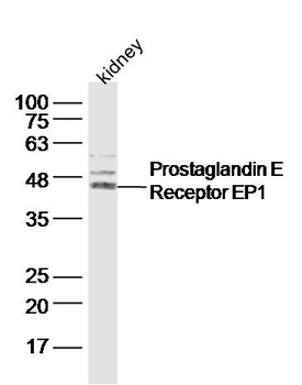 PTGER1 Rabbit Polyclonal Antibody