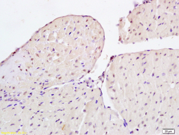 CIDEC Rabbit Polyclonal Antibody