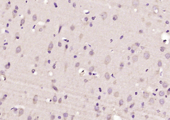 GAS2L1 Rabbit Polyclonal Antibody