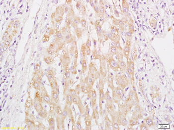 FUT1 Rabbit Polyclonal Antibody