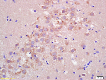 FIS1 Rabbit Polyclonal Antibody