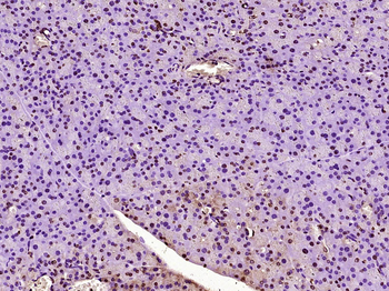 NUPR1 Rabbit Polyclonal Antibody