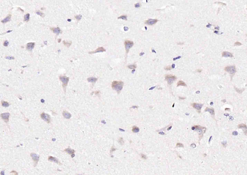 Amyloid Precursor Protein Mouse Polyclonal Antibody