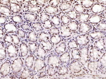 SPC25 Rabbit Polyclonal Antibody