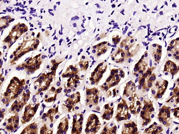 DCTN3 Rabbit Polyclonal Antibody