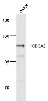 CDCA2 Rabbit Polyclonal Antibody