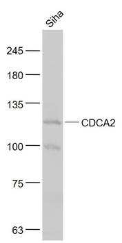 CDCA2 Rabbit Polyclonal Antibody