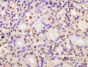 CDCA2 Rabbit Polyclonal Antibody