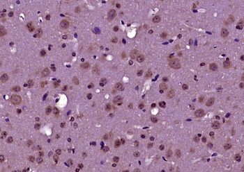 RABGAP1 Rabbit Polyclonal Antibody