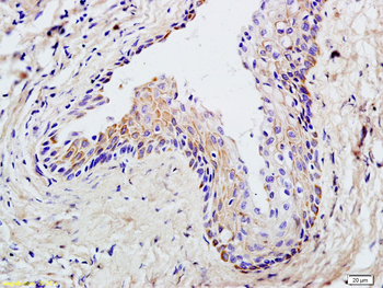 APPL1 Rabbit Polyclonal Antibody