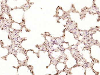 ZNF693 Rabbit Polyclonal Antibody