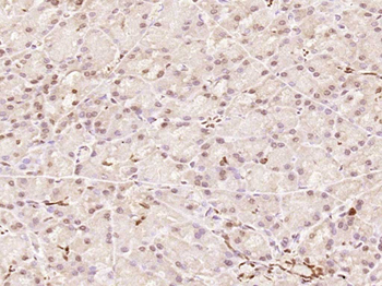 ZNF693 Rabbit Polyclonal Antibody