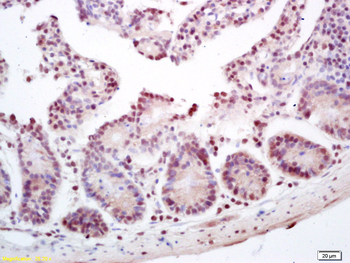 ZNF693 Rabbit Polyclonal Antibody