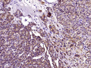 SPINK1 Rabbit Polyclonal Antibody