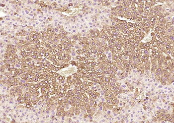 KLST/Kallistatin Rabbit Polyclonal Antibody