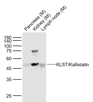 KLST/Kallistatin Rabbit Polyclonal Antibody