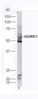 ADAM11 Rabbit Polyclonal Antibody