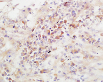 ADAMTS13 Rabbit Polyclonal Antibody