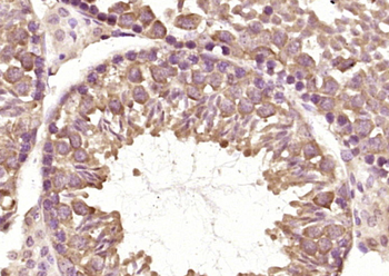 FBXO31 Rabbit Polyclonal Antibody