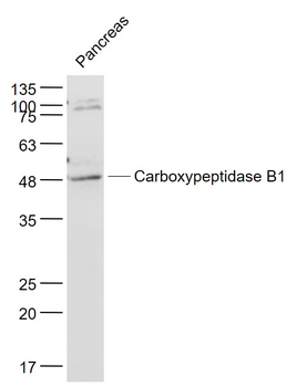 Carboxypeptidase B1 Rabbit Polyclonal Antibody