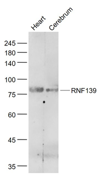 RNF139 Rabbit Polyclonal Antibody
