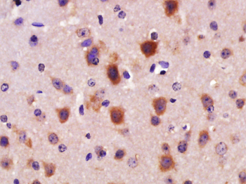 AR/Androgen Receptor Rabbit Polyclonal Antibody