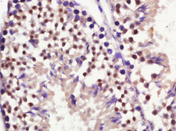AR/Androgen Receptor Rabbit Polyclonal Antibody