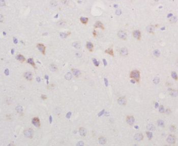 Transglutaminase 2 Rabbit Polyclonal Antibody
