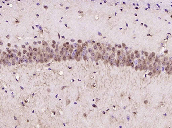 ROR beta Rabbit Polyclonal Antibody