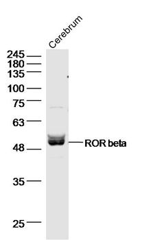 ROR beta Rabbit Polyclonal Antibody