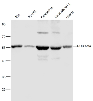 ROR beta Rabbit Polyclonal Antibody