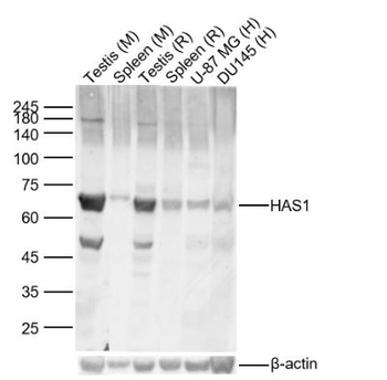 HAS1 Rabbit Polyclonal Antibody