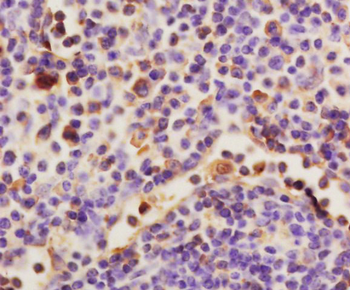 HAS1 Rabbit Polyclonal Antibody
