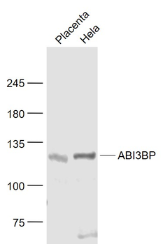 ABI3BP Rabbit Polyclonal Antibody