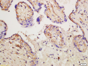 ABI3BP Rabbit Polyclonal Antibody