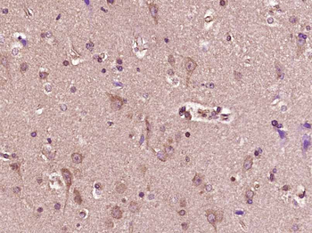 PRSS3 Rabbit Polyclonal Antibody