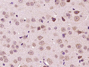 PRSS3 Rabbit Polyclonal Antibody