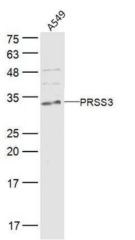 PRSS3 Rabbit Polyclonal Antibody