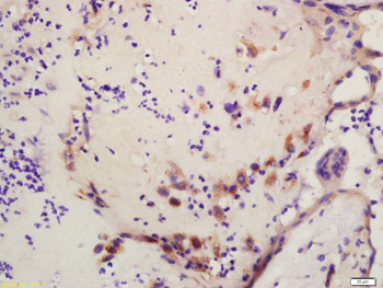 RBBP6 Rabbit Polyclonal Antibody