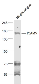 ICAM5 Rabbit Polyclonal Antibody