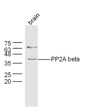 PP2A beta antibody