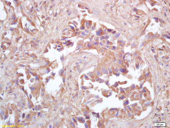 HSPE1 Rabbit Polyclonal Antibody