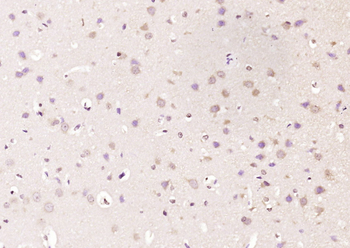 DLK1 Rabbit Polyclonal Antibody