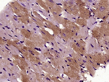 LECT1 Rabbit Polyclonal Antibody